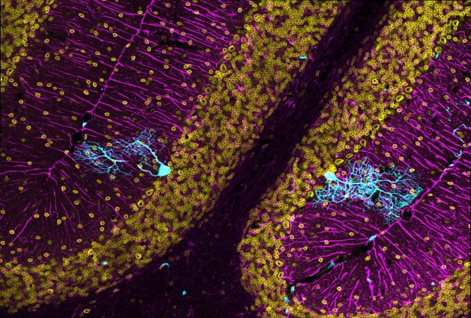La imagen muestra una inmunofluorescencia de una sección de cerebelo con dos células de Purkinje fusionadas que expresan GFP en color cian